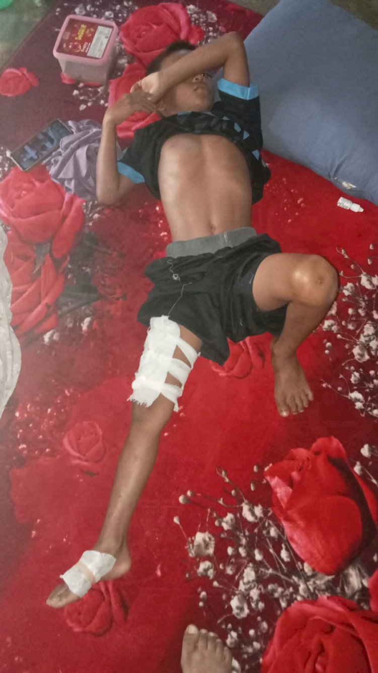 Bocah 9 Tahun Jatuh Dari Jembatan Ketinggian 7 Meter, Panglima  Daerah III Minta PGE Bangun Pembatas.